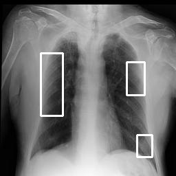 x-ray image